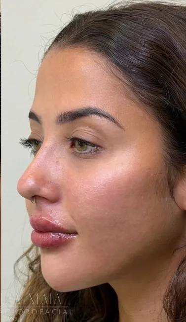 Perfil valorizado com naturalidade after