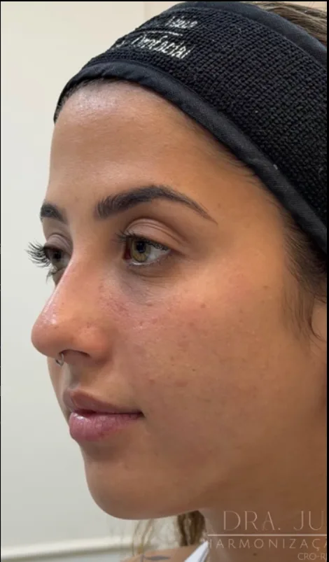 Perfil valorizado com naturalidade before